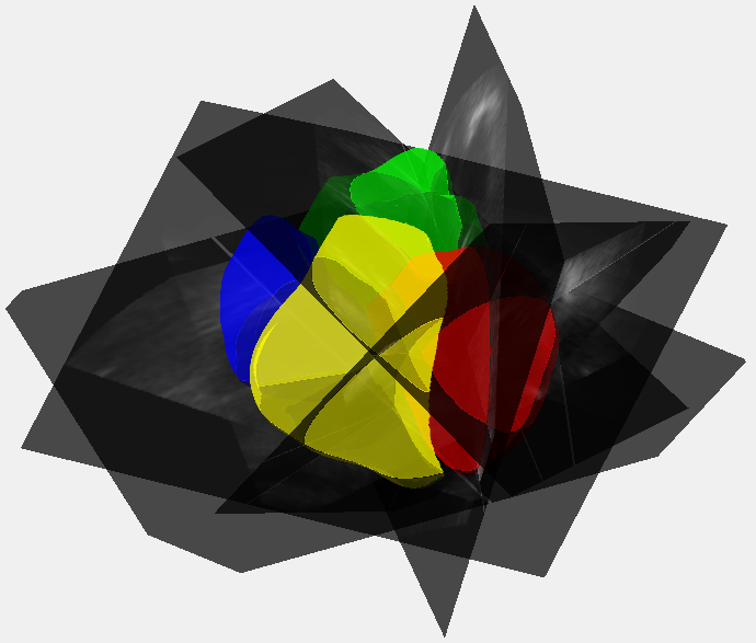 Representação das cinco vistas cardíacas em 3D