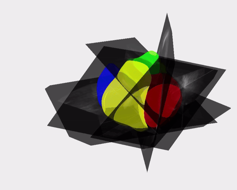 Animação com as cinco vistas cardíacas em 3D